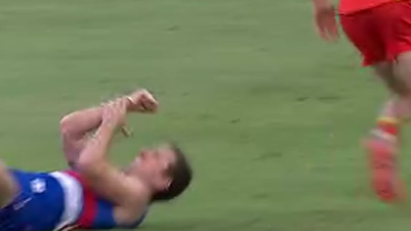 Bulldogs' Morris breaks arm against Suns