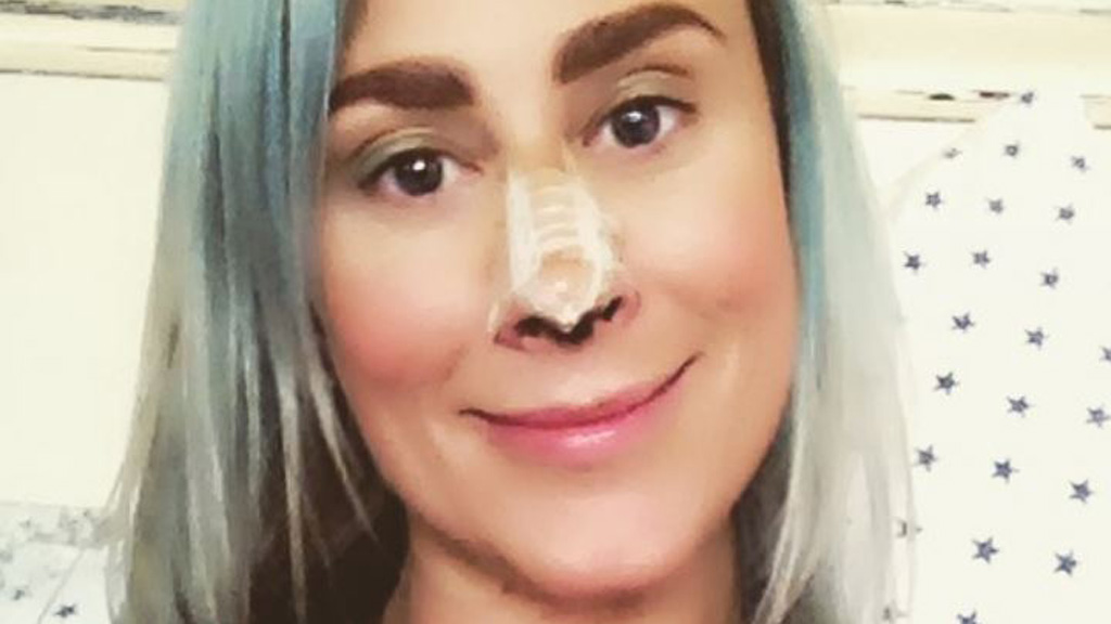 Selfie dysmorphia plastic surgery costs mum thousands 9Honey