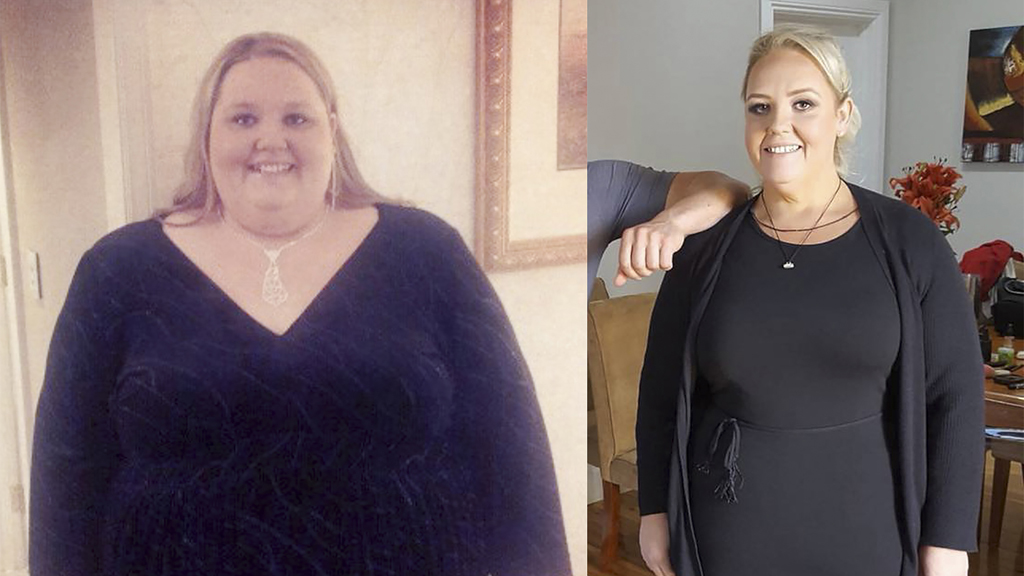 Australian Woman Loses Half Her Body Weight 9honey 8750