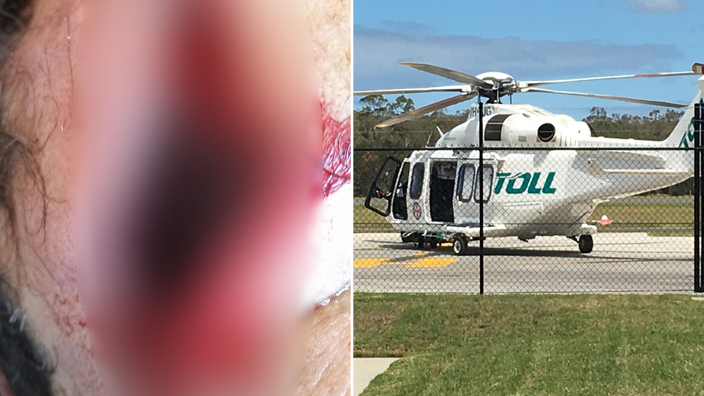 Exploding angle grinder hits man in face