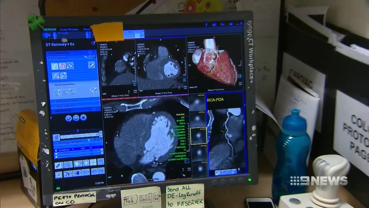 Bone density scans could identify risk of heart disease