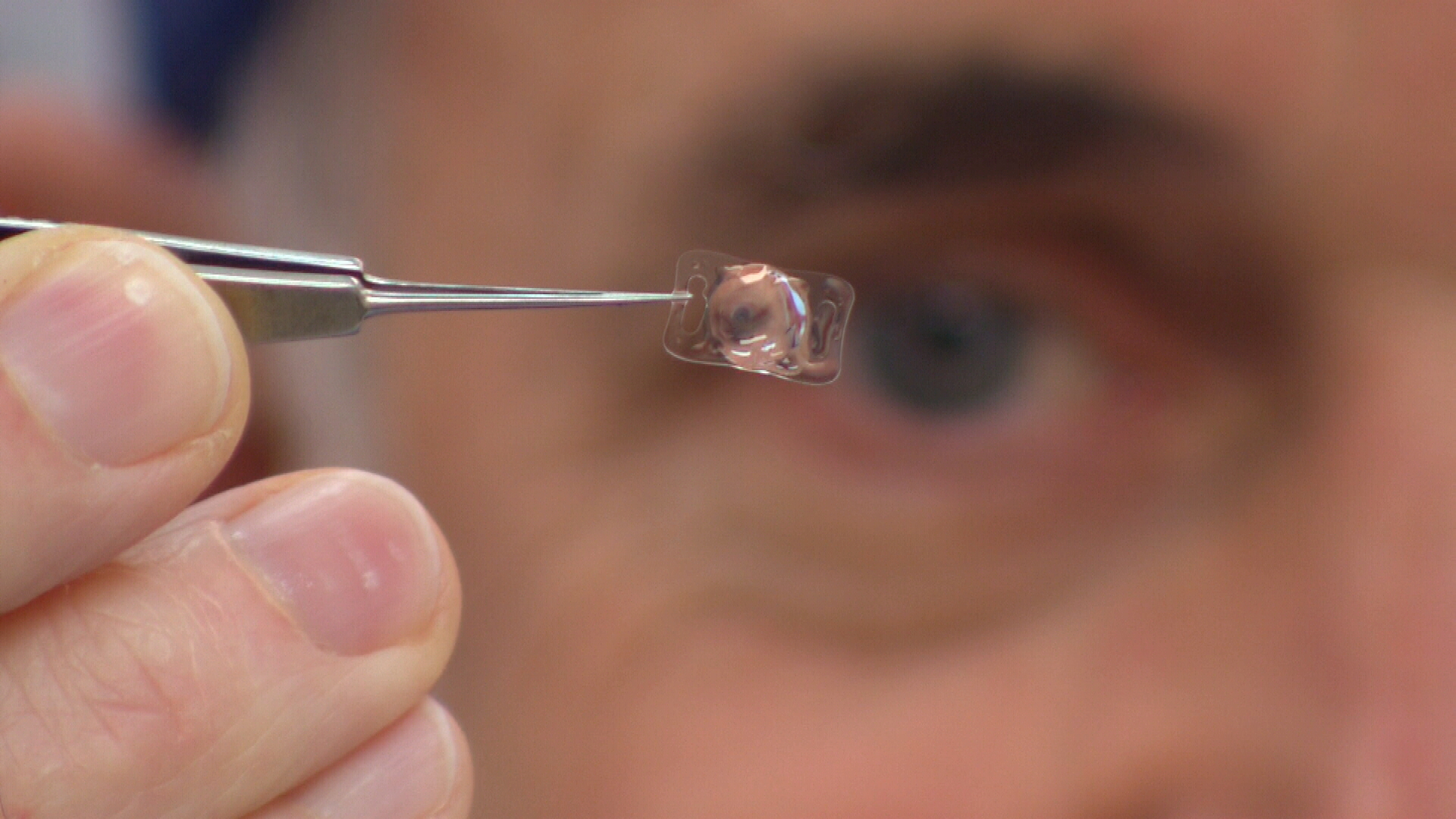 New Artificial Lens May Improve Sight After Cataract Surgery