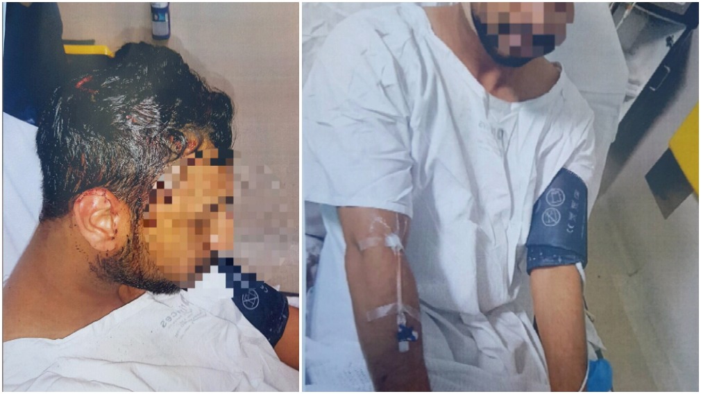 Uni student tasered, bashed in 'horrendous' night-time ambush