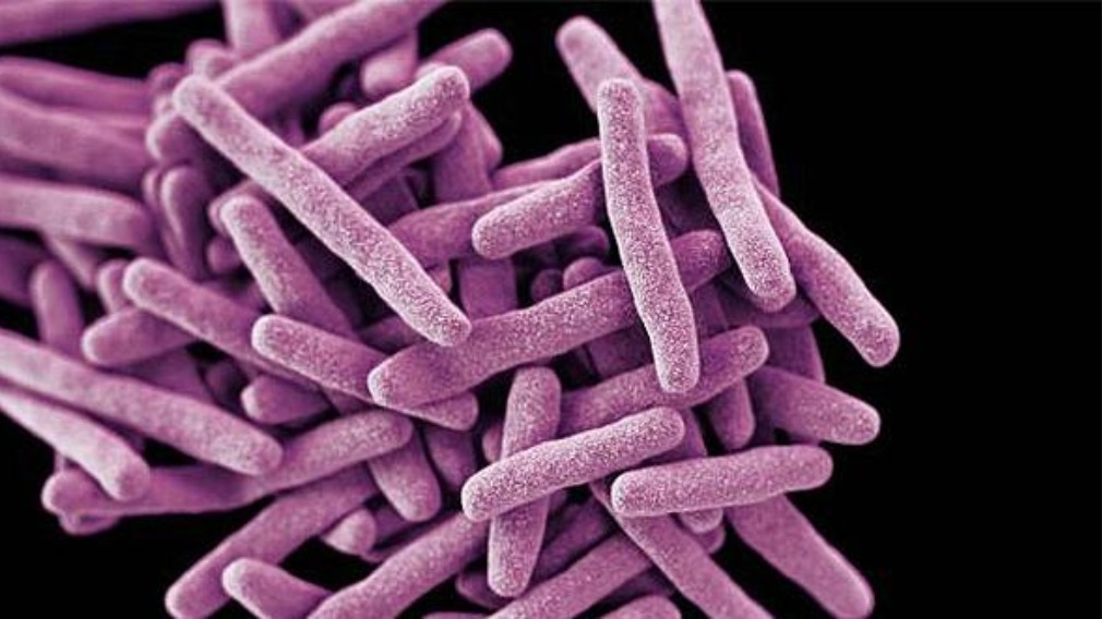 Candida auris rare superbug found in Victoria