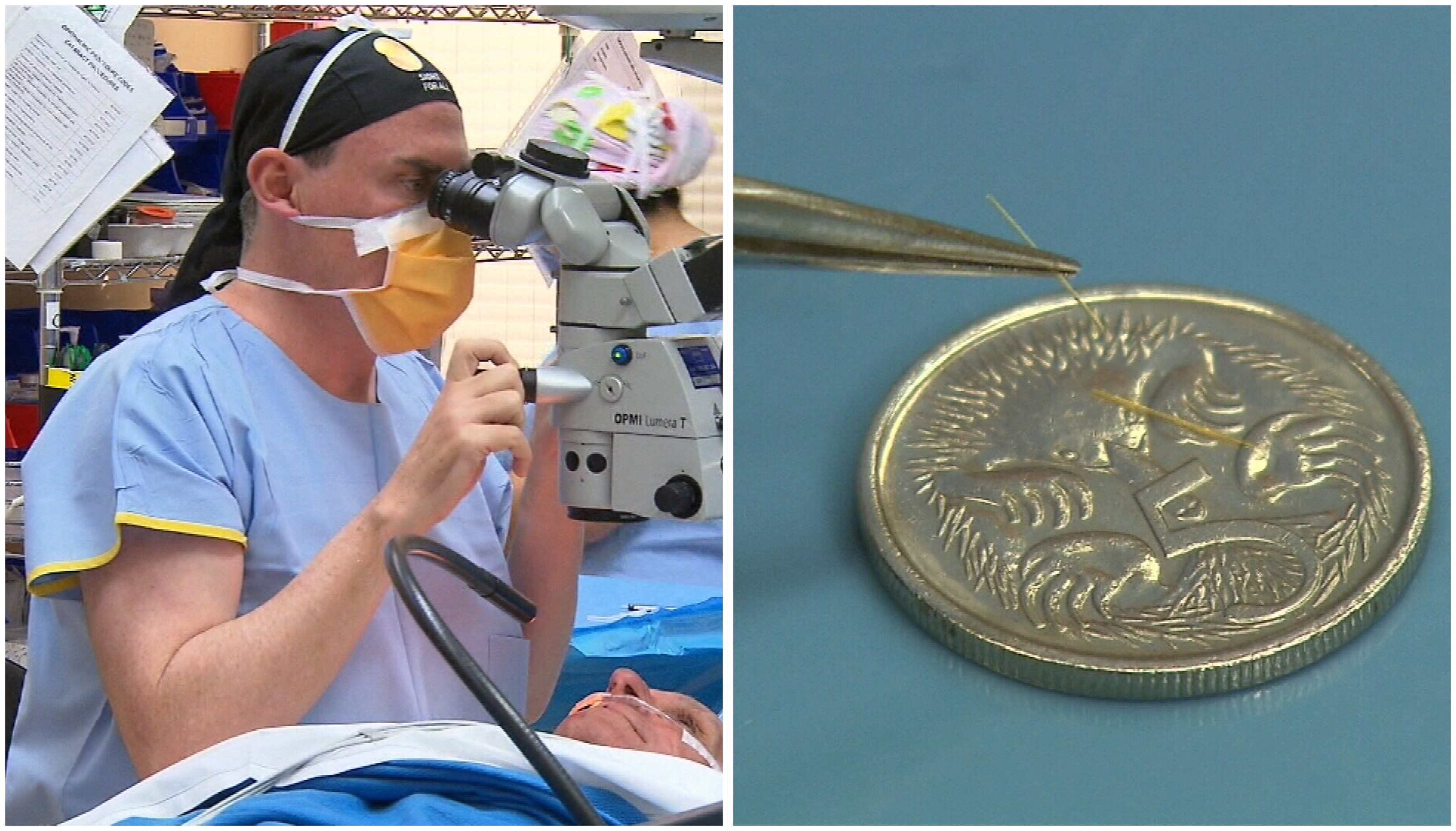 Cpt Code Xen Gel Stent at Ronald Garrett blog