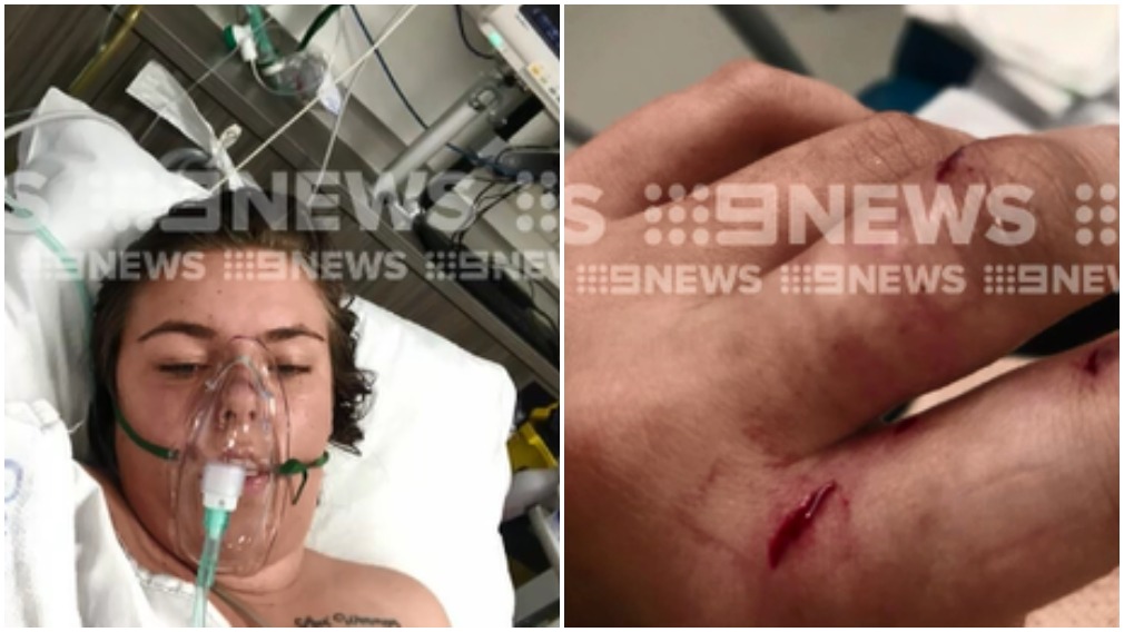 'I thought I was going to die': Expectant mum attacked by dog in Victoria