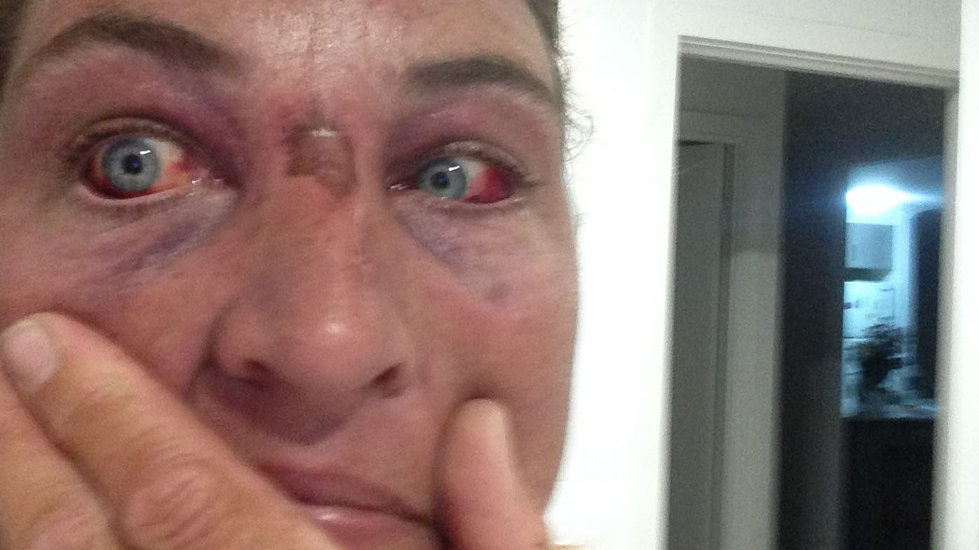 Queensland snake catcher strangled by python