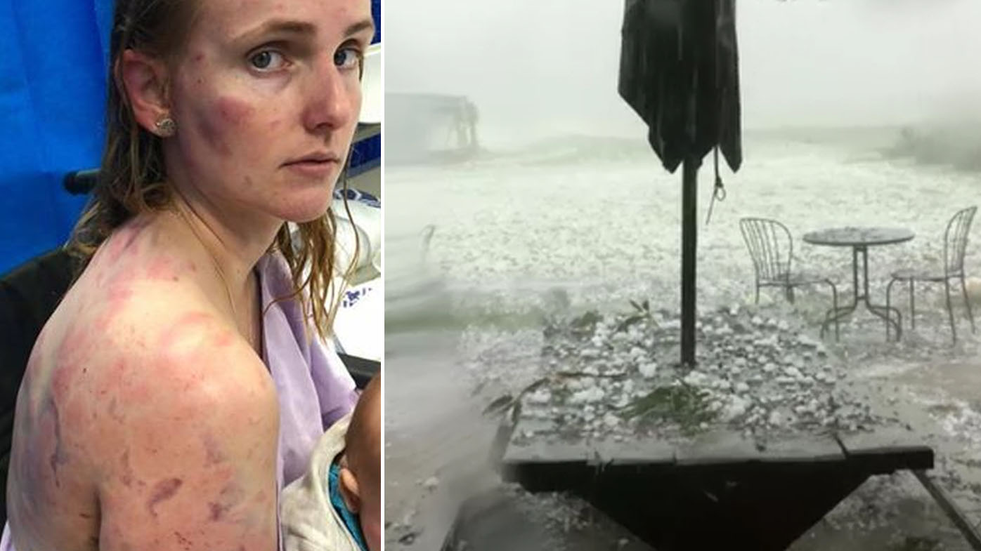 Fiona Simpson: Queensland mum battered by fierce hail protecting her baby