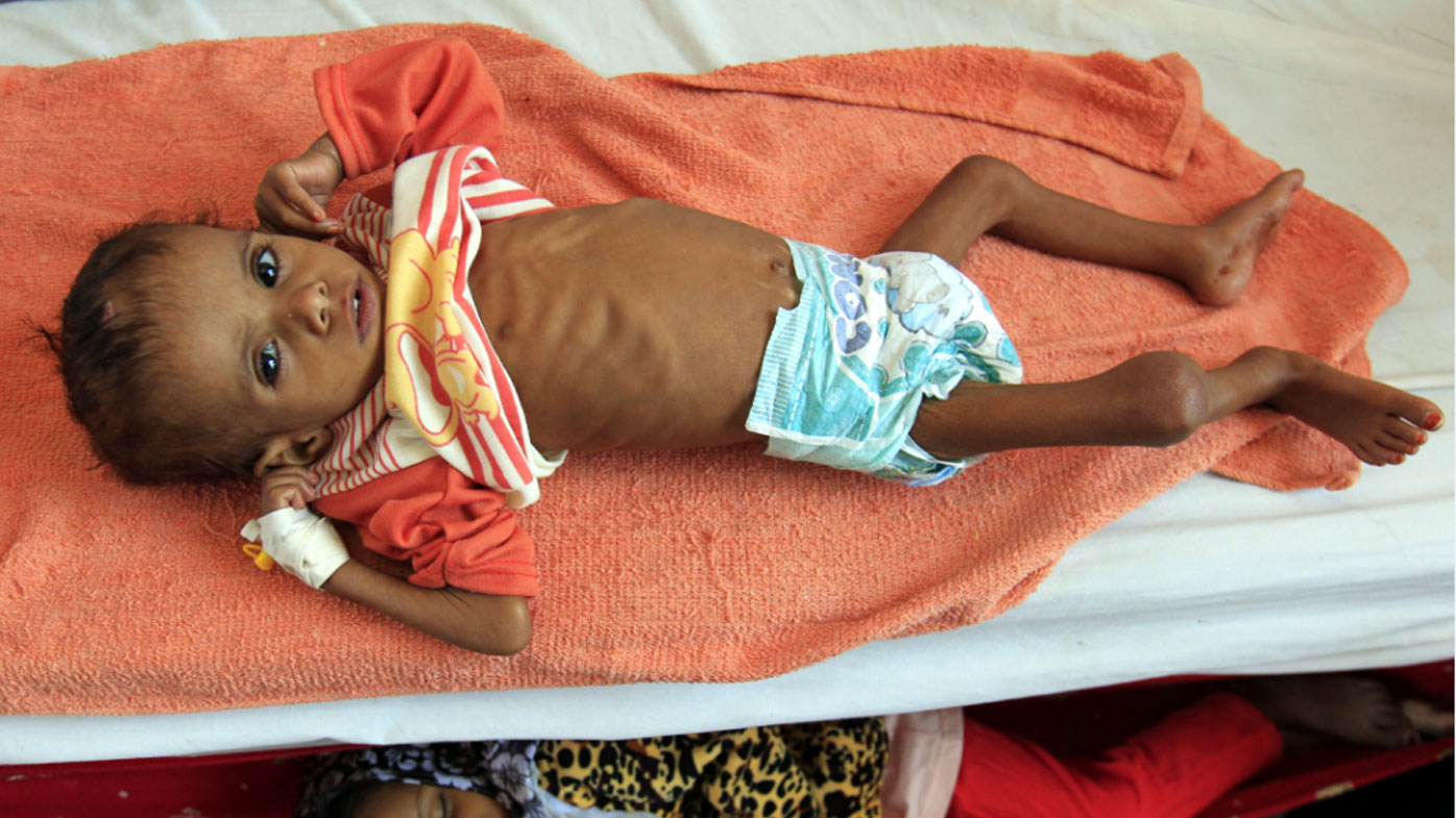 Millions Face Starvation In Yemen 