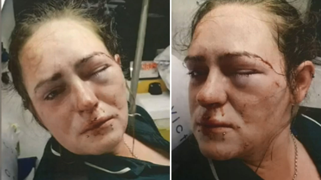 Paramedic beaten with deodorant can in ‘road rage’ attack