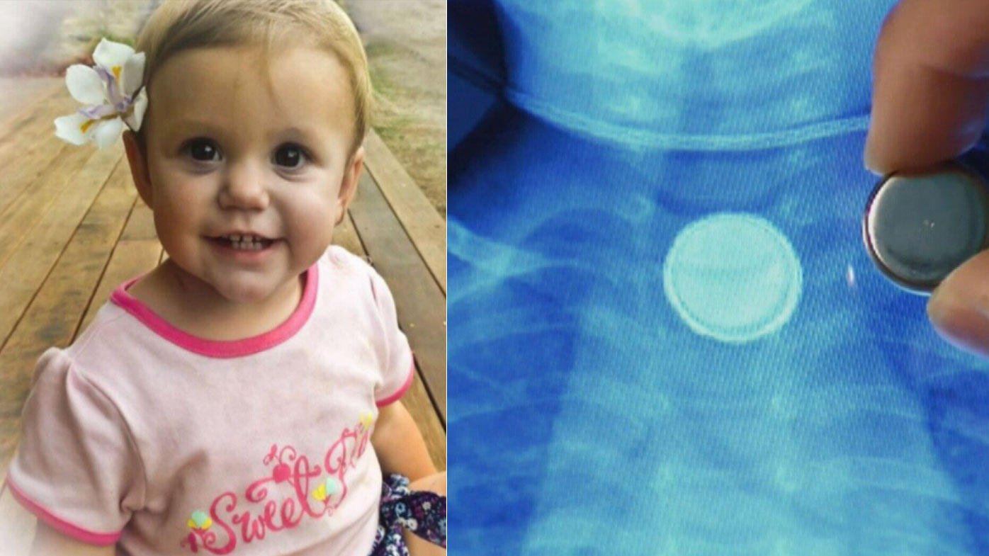 Toddler swallows button battery Hospital �didn�t believe