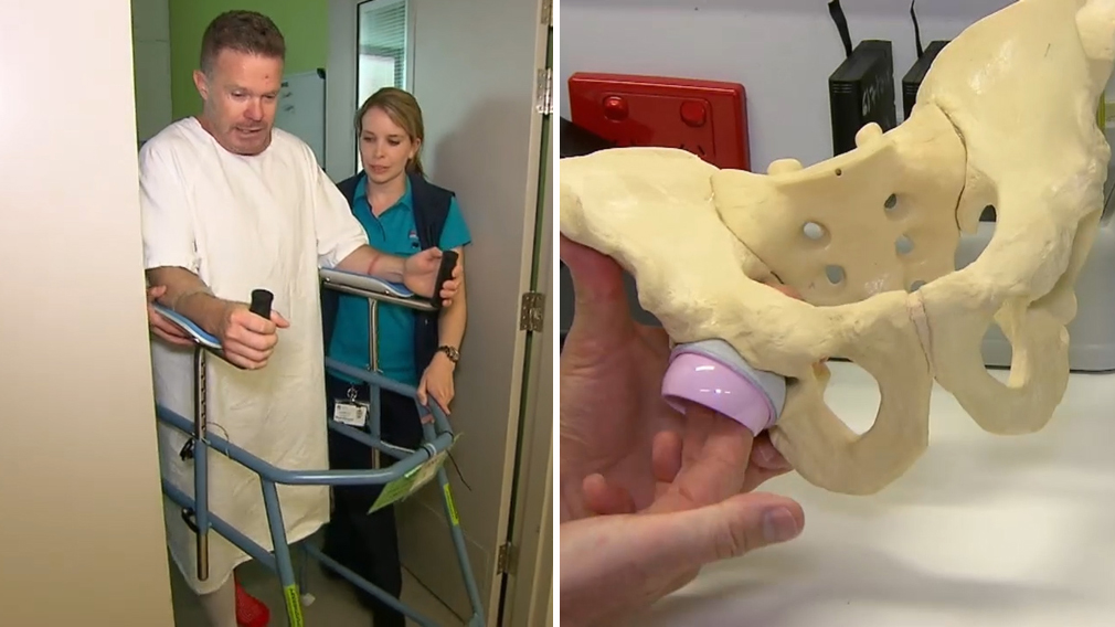 Hip surgery Sydney man receives ceramic hip in worldfirst study