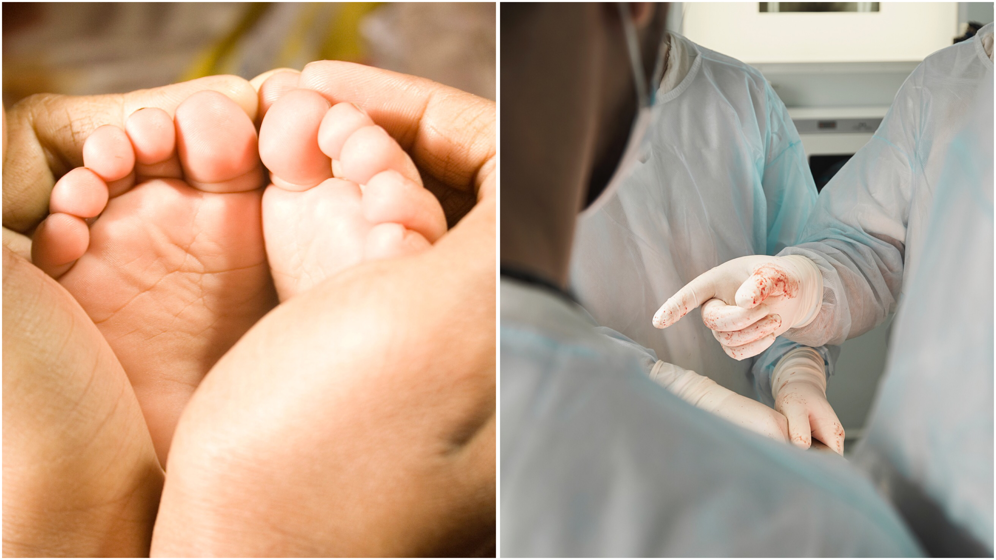Nurse 'pulls baby's head off during birth'