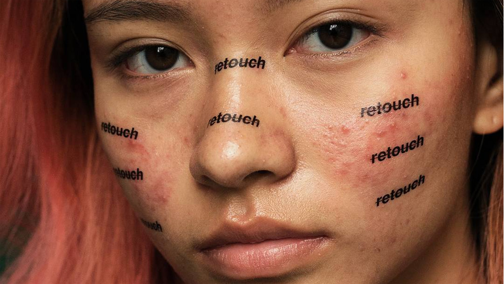 all-the-models-in-these-photos-have-acne-9style