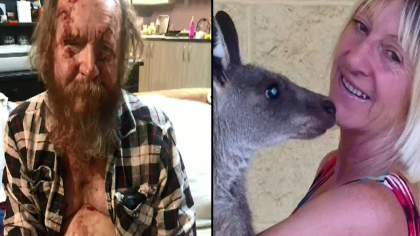 Kangaroo attack Couple determined to continue work as wildlife carers