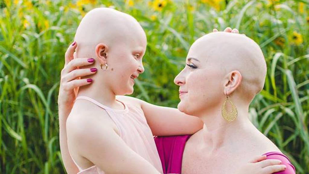 Beautiful Mother Daughter Bald Photoshoot Goes Viral 9honey