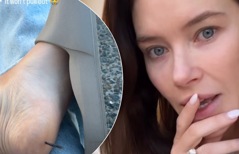 Brittany Hockley reveals gruesome injury as she gets a nail stuck in her foot: 'This thing is hooked in there'