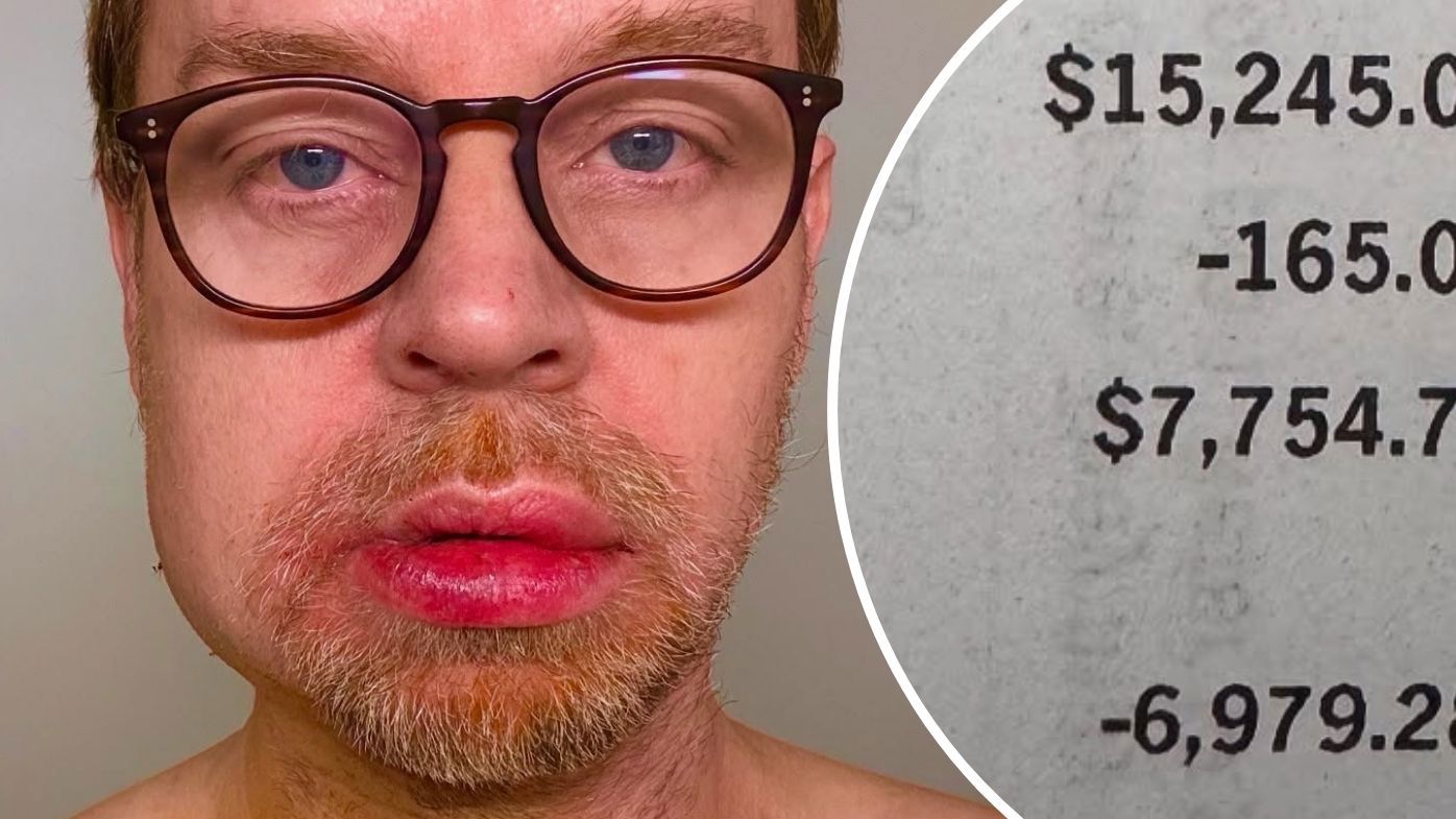 'America is broken': Aussie star Darren Hayes reveals staggering cost of near-death accident