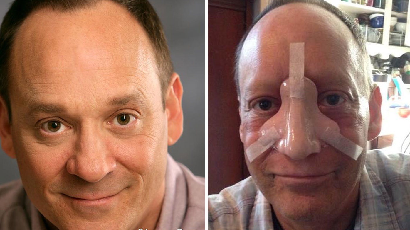 'Ray Donovan' actor Steve 'Bean' Levy dies after battle with nose cancer 9Celebrity