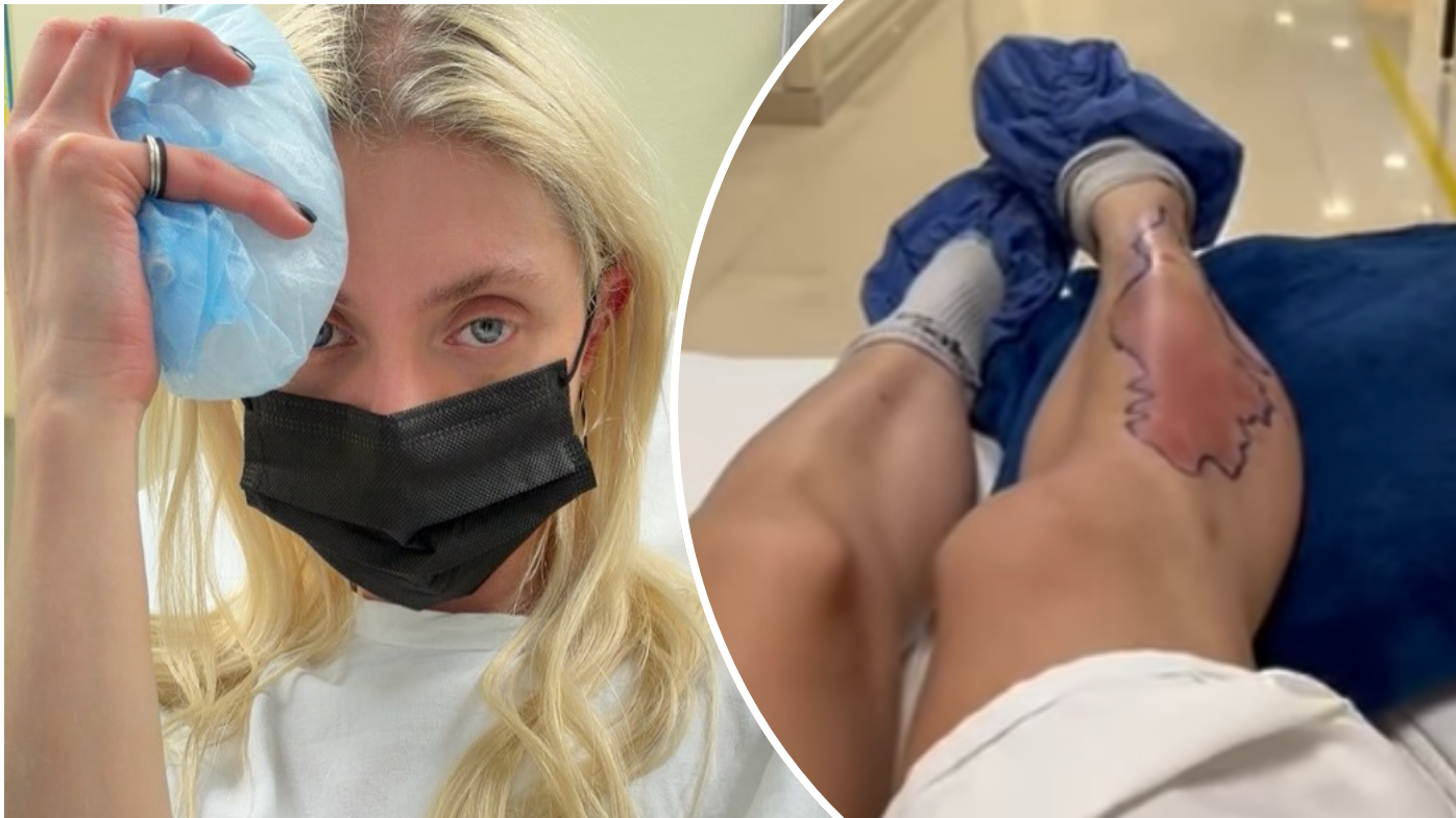 Singer Taylor Momsen hospitalised after venomous spider bite during AC/DC tour in Mexico