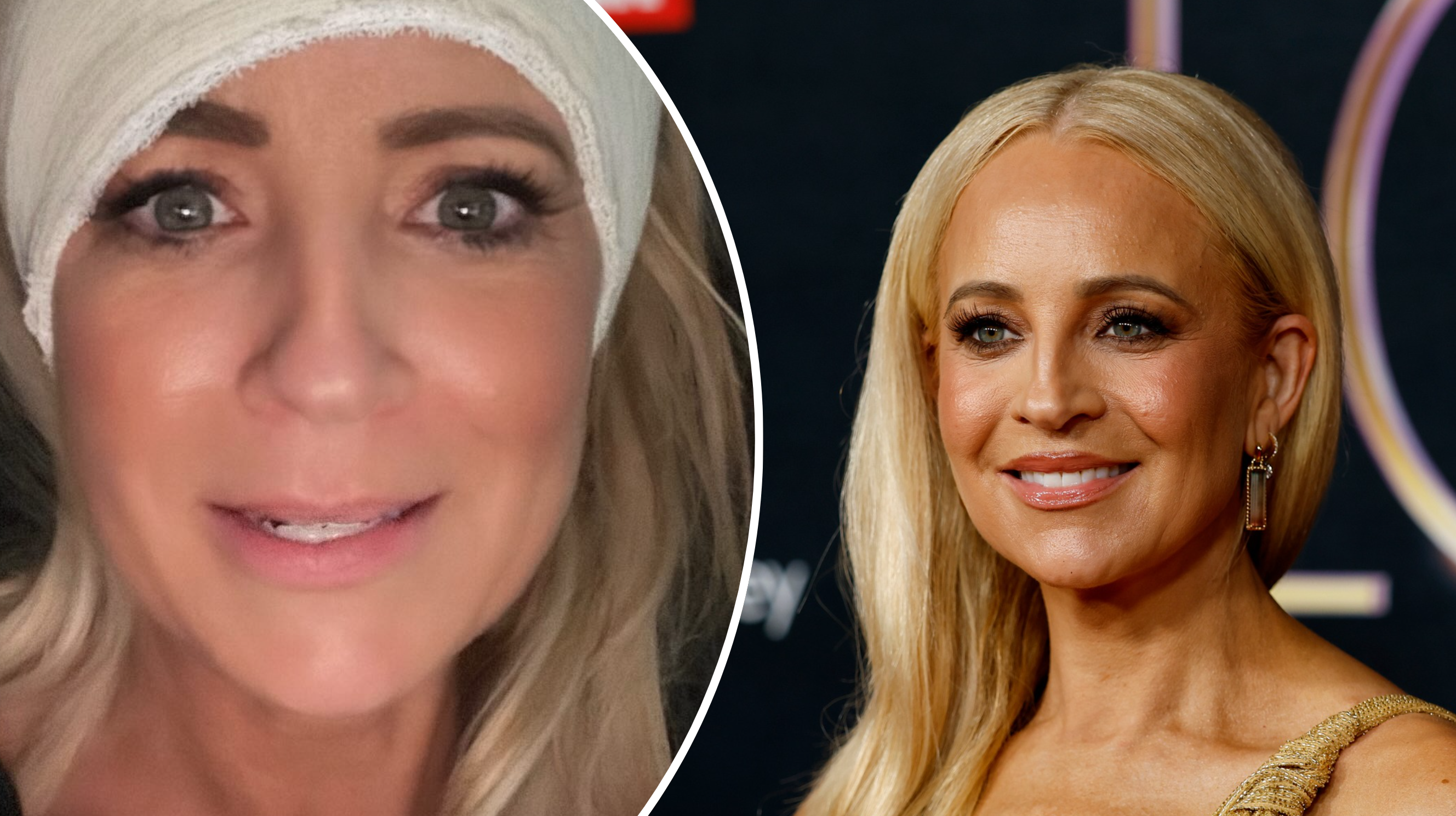 Carrie Bickmore gives update following 'crime scene' head injury