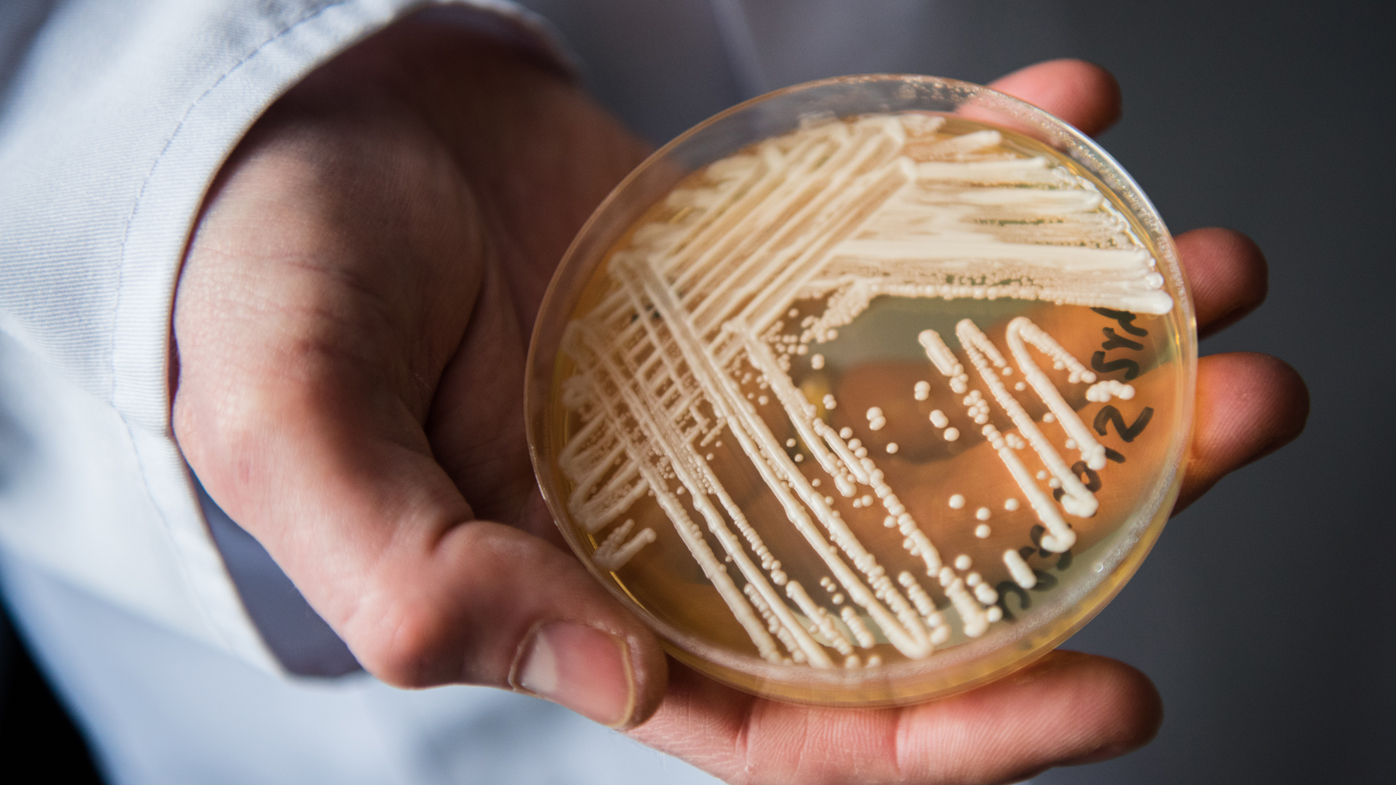 Candida auris deadly fungal superbug spreading Australia