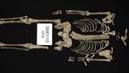 The headless remains of infamous Victorian bushranger Ned Kelly. (AAP)
