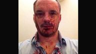 A photo of Christopher Bryant after the attack.