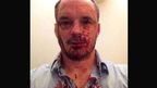 A photo of Christopher Bryant after the attack.