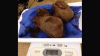 The giant hairball that was surgically extracted from a tiger named Ty yesterday.