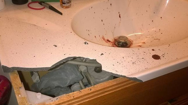 US man left with devastating injuries after e-cigarette explosion