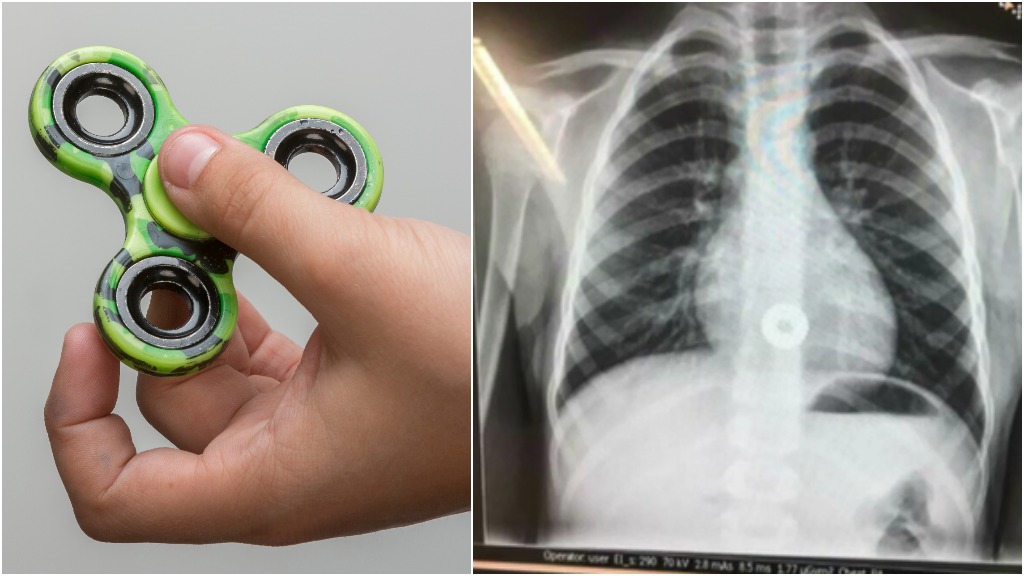 Fidget spinner ebay clearance australia