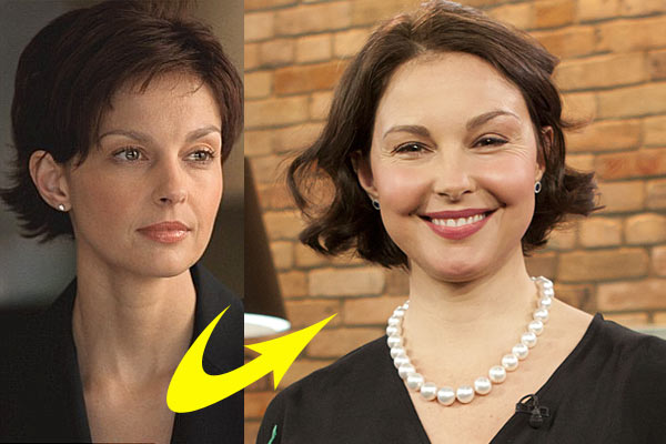 WTF happened to Ashley Judd's face? Swollen cheeks spark plastic ...