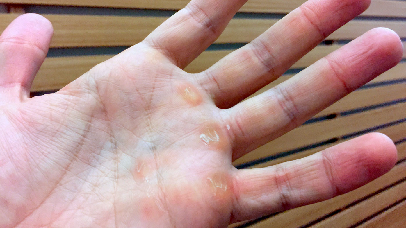 How to fix your callused, gross, crusty gym hands | 9Coach