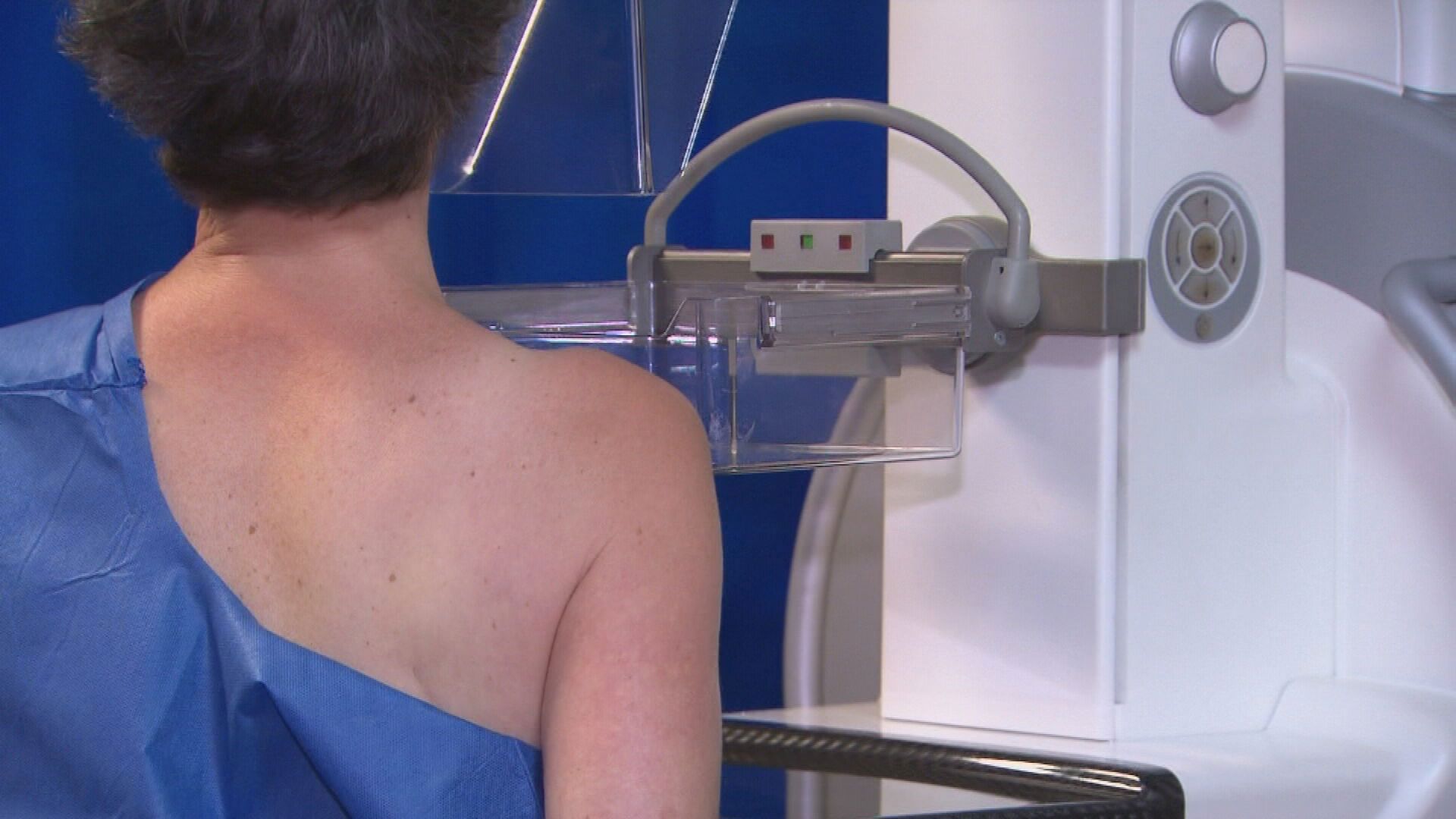 Australian researchers have found a new treatment that can dramatically improve survival rates for a common form of breast cancer.﻿