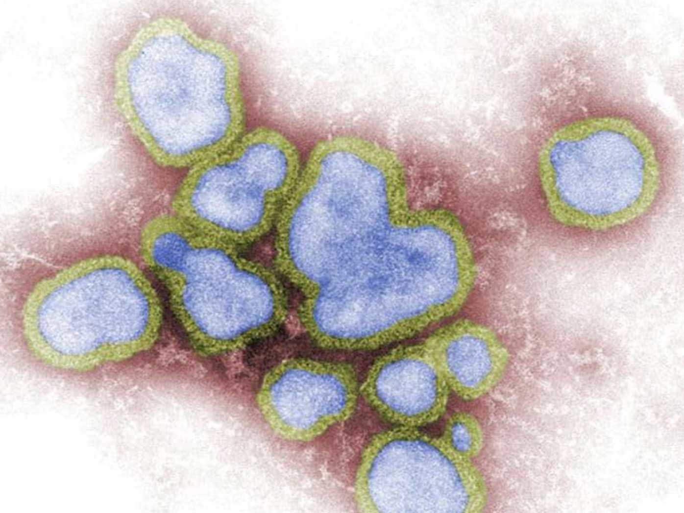 Influenza A is a particularly nasty virus spreading around Australia.