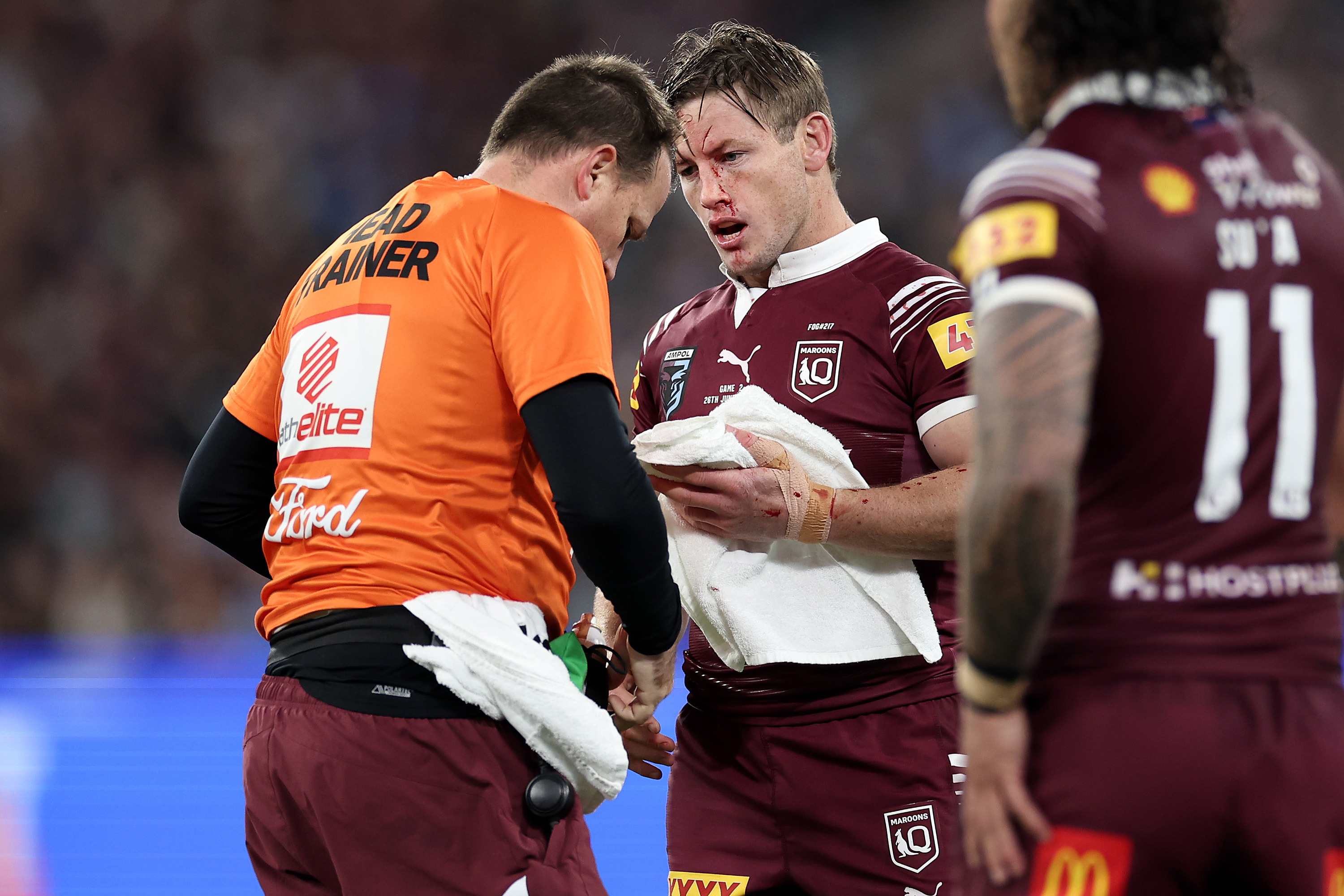 Harry Grant of the Maroons is attended to by a trainer after copping a knock to the face.