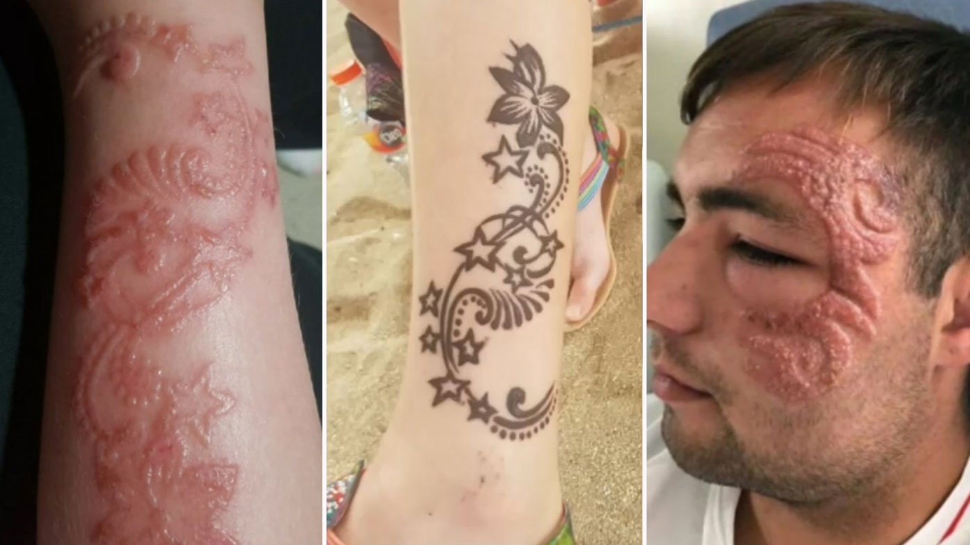 Dangerous black  henna  tattoos  leaving Bali  tourists with 