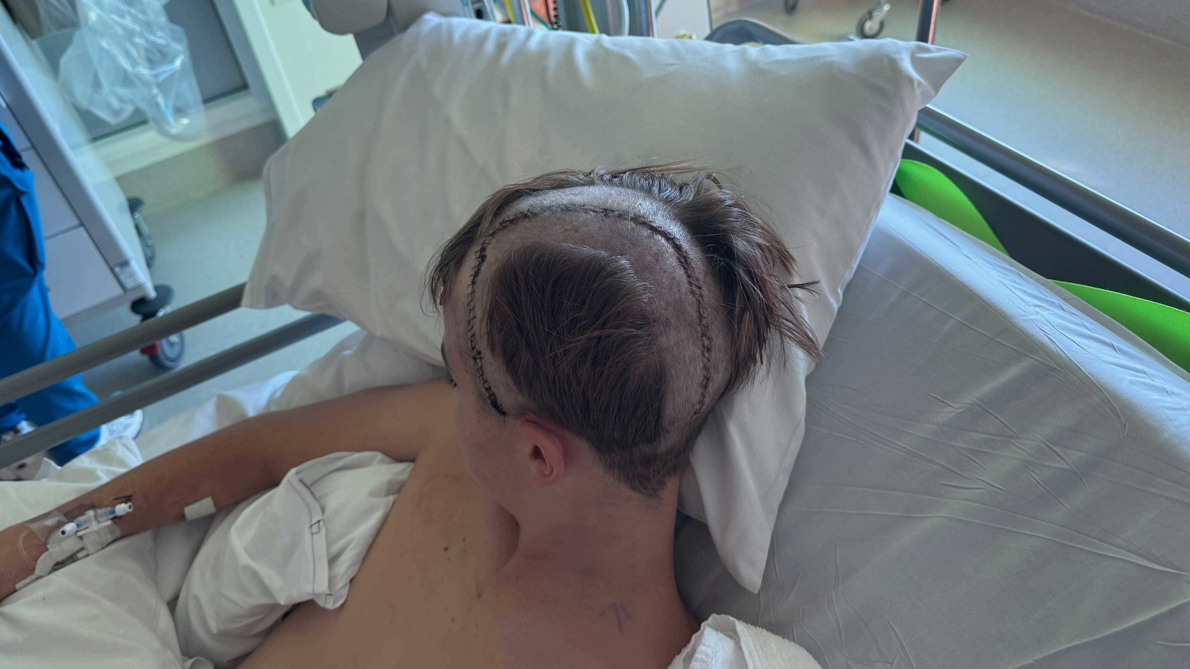 Theo Phillips is now recovering after undergoing two brain surgeries.