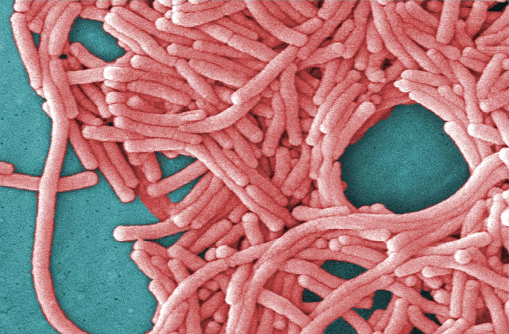 One dead after outbreak of rare disease in Sydney