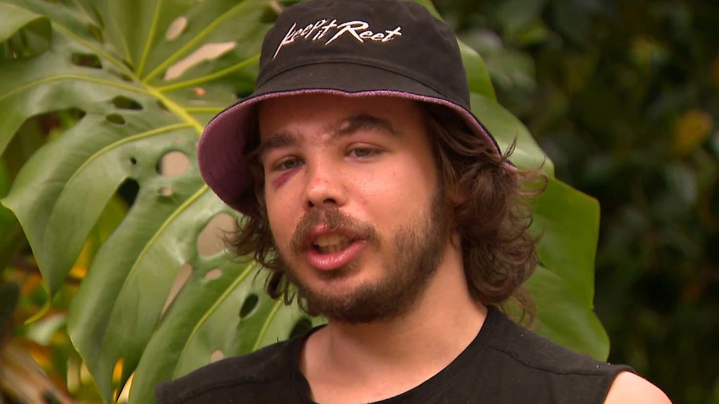 A﻿ Melbourne tradie has been left with serious injuries to his face after being attacked by an e-scooter rider in a road rage incident.Tyler Macaloney was driving home from his panel beating job in Parkville on﻿ Friday when he was confronted by a man who was weaving in and out of traffic.