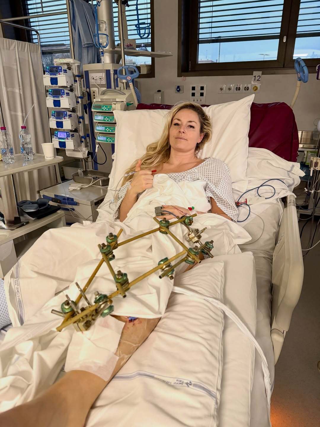 Skiing star Lindsey Vonn took to instagram to give an update on her health after undergoing surgery on her broken leg.