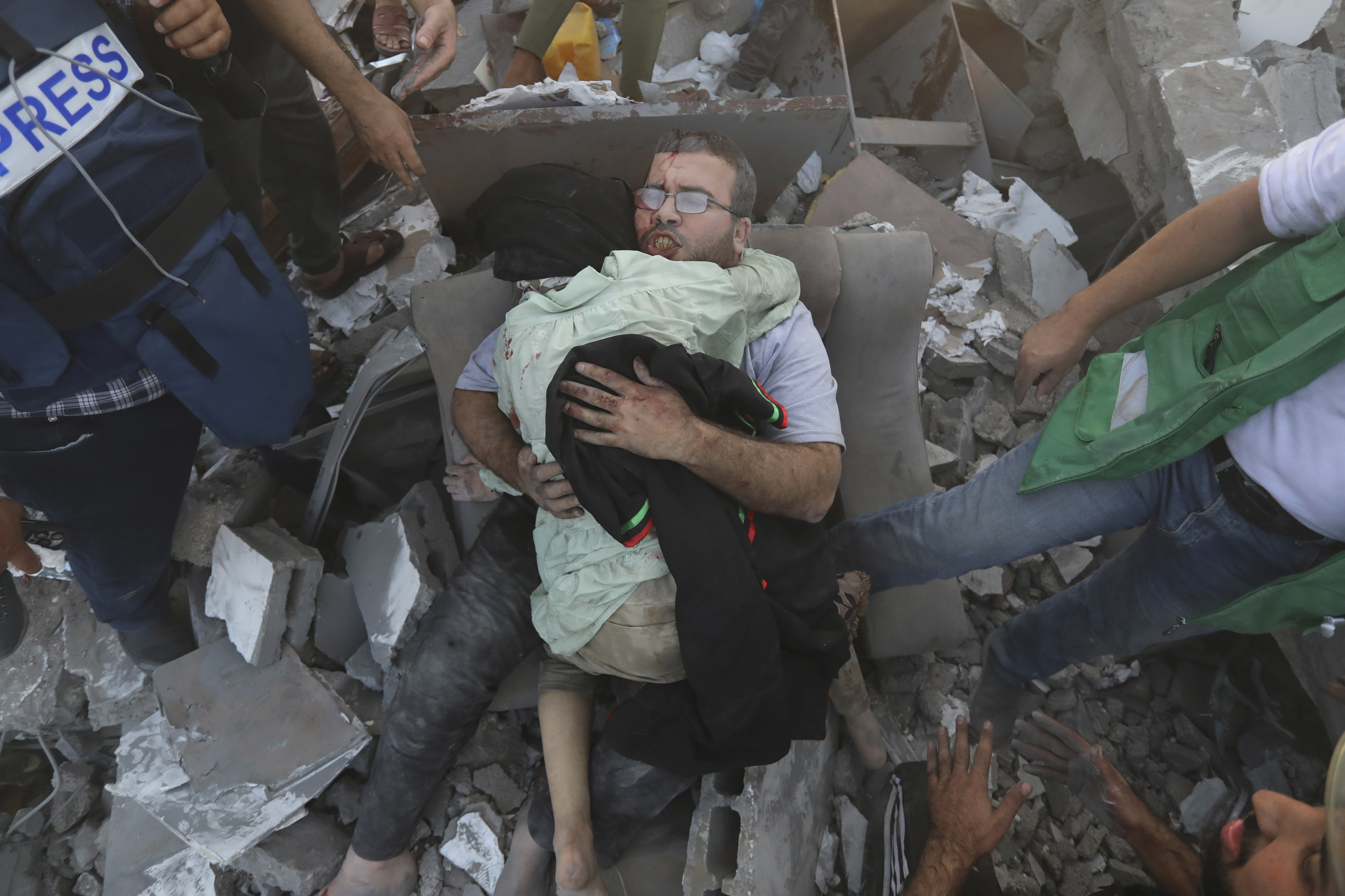 An injured Palestinian man hugs an injured relative