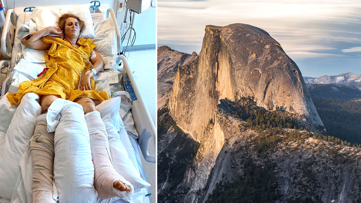 La escaladora neozelandesa Anna Parsons yace en una cama de hospital en California, después de caerse de una roca en el Parque Nacional Yosemite.