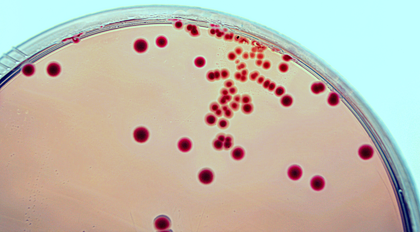 E. coli grown on an agar plate over night. 