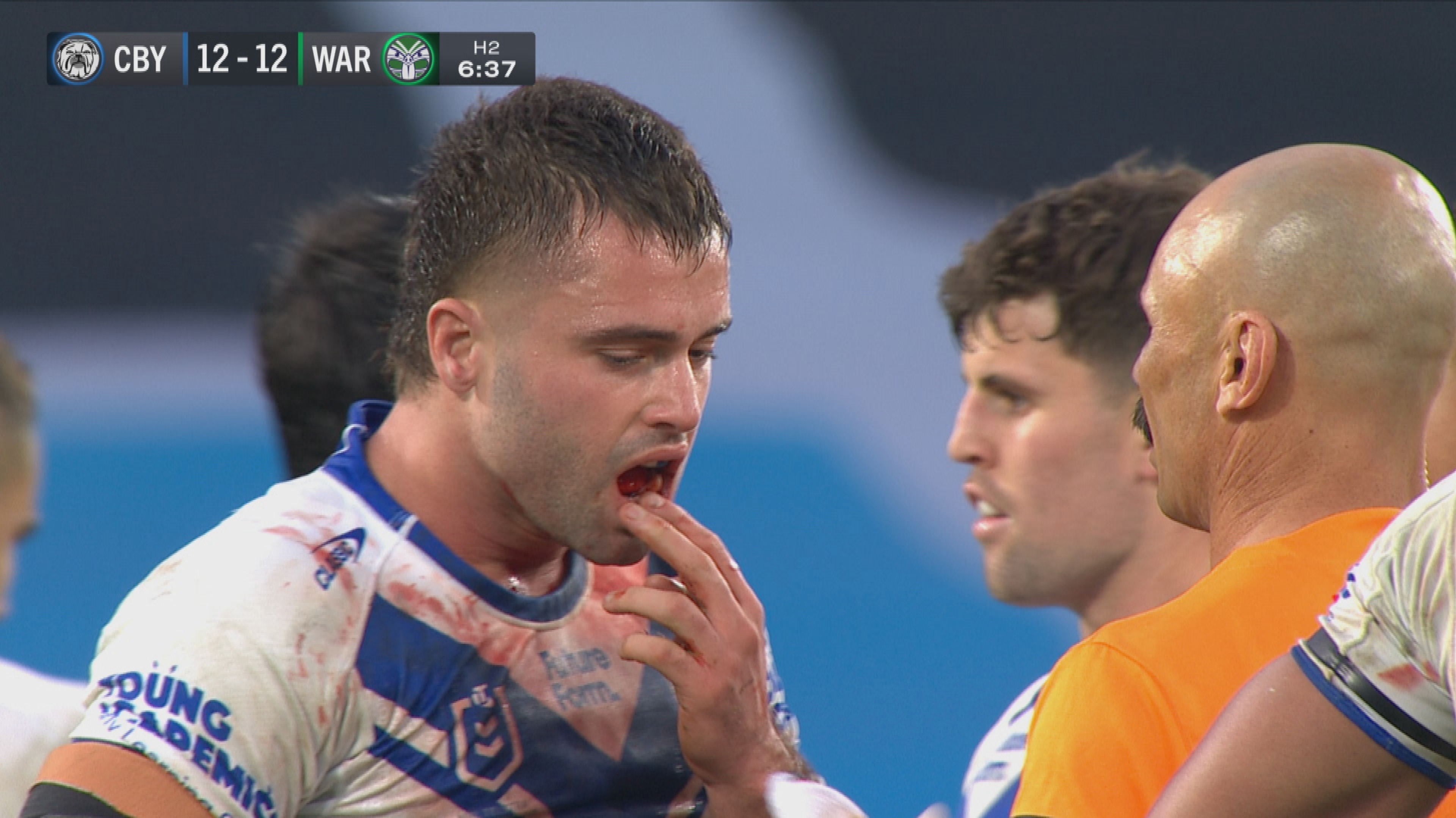 Jaemon Salmon holds jaw. Bulldogs v Warriors.