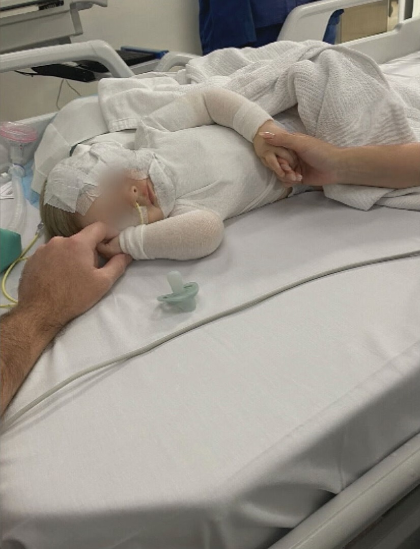 A baby boy is in hospital recovering from a horrific burns after a stranger poured hot coffee over his head in a Brisbane park.