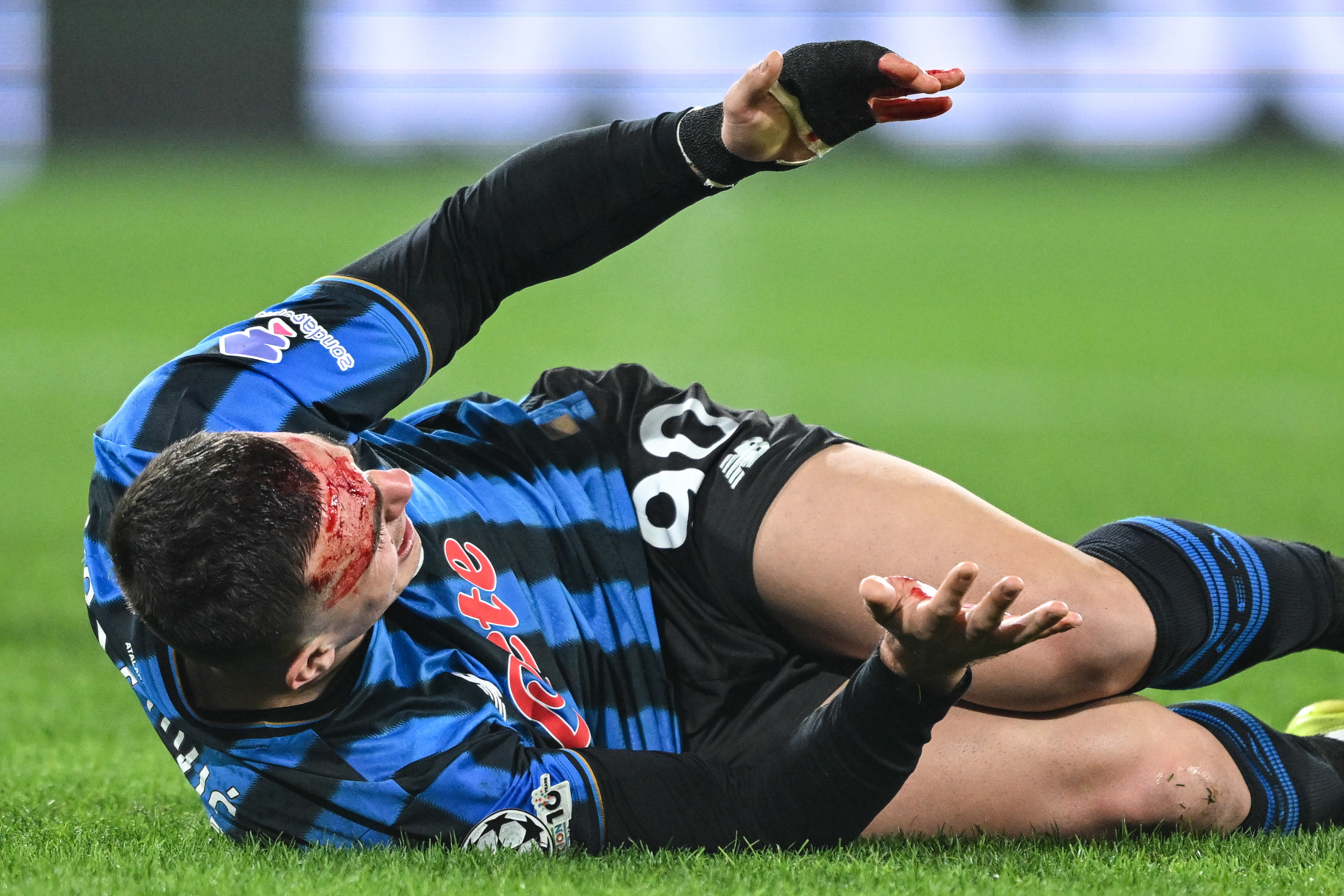 Nikola Krstovic of Atalanta BC sustains an injury during the UEFA Champions League 2025/2026 Knockout Play-off Second Leg between Atalanta BC and Borussia Dortmund in Bergamo, Italy, on February 25, 2026, at New Balance Arena stadium (Photo by Tiziano Ballabio/NurPhoto).