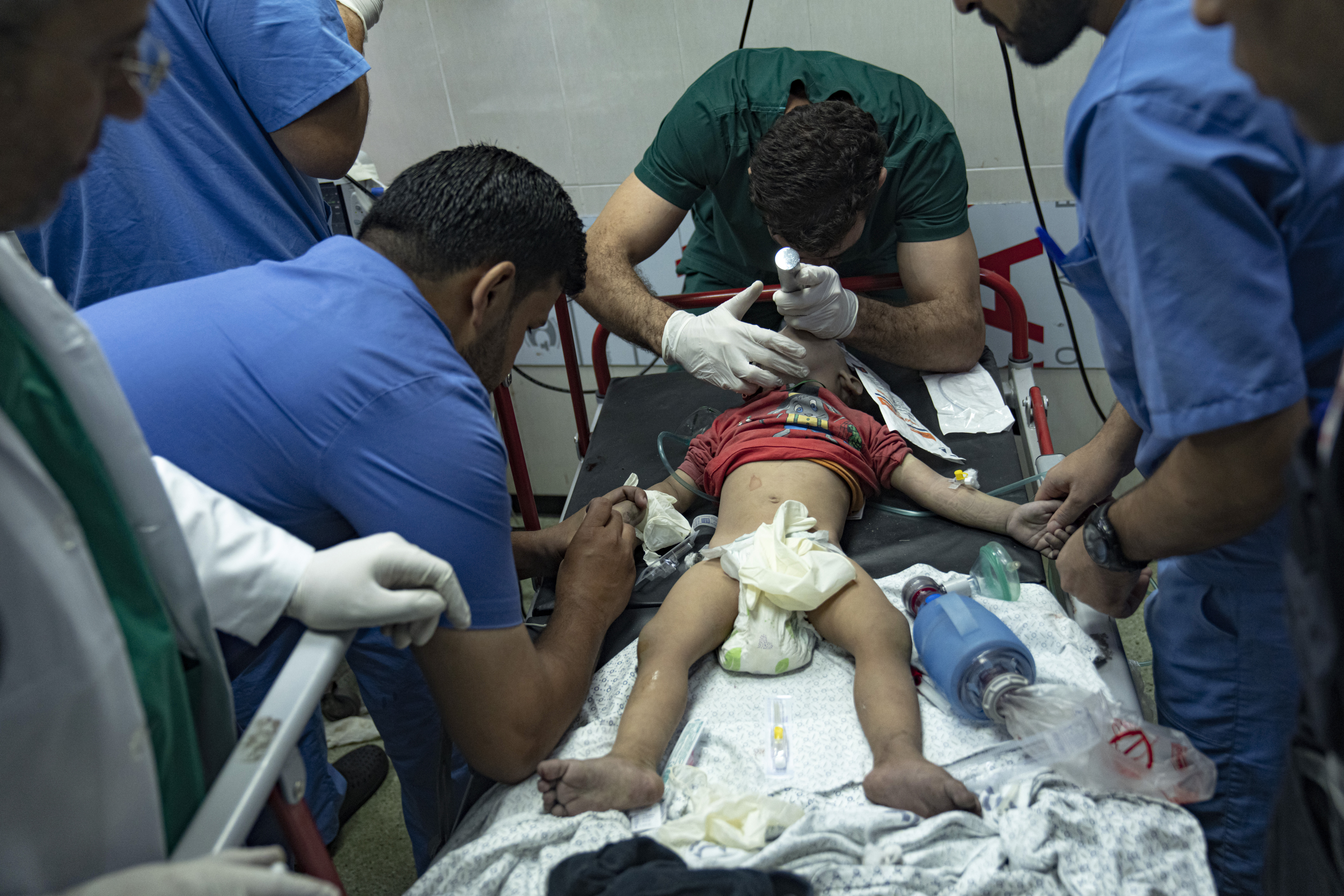 Palestinian medics treat a child