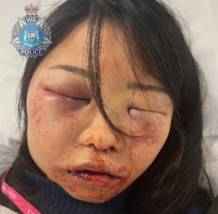 A Perth woman has been left with severe facial injuries after she was assaulted during a break-in at her home.